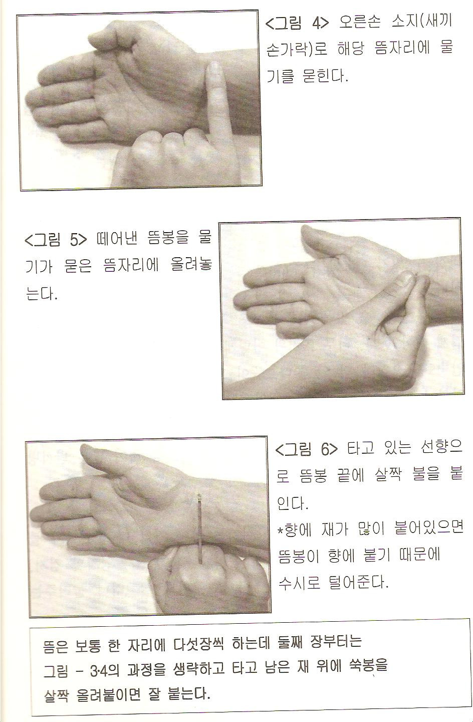 뜸 이미지