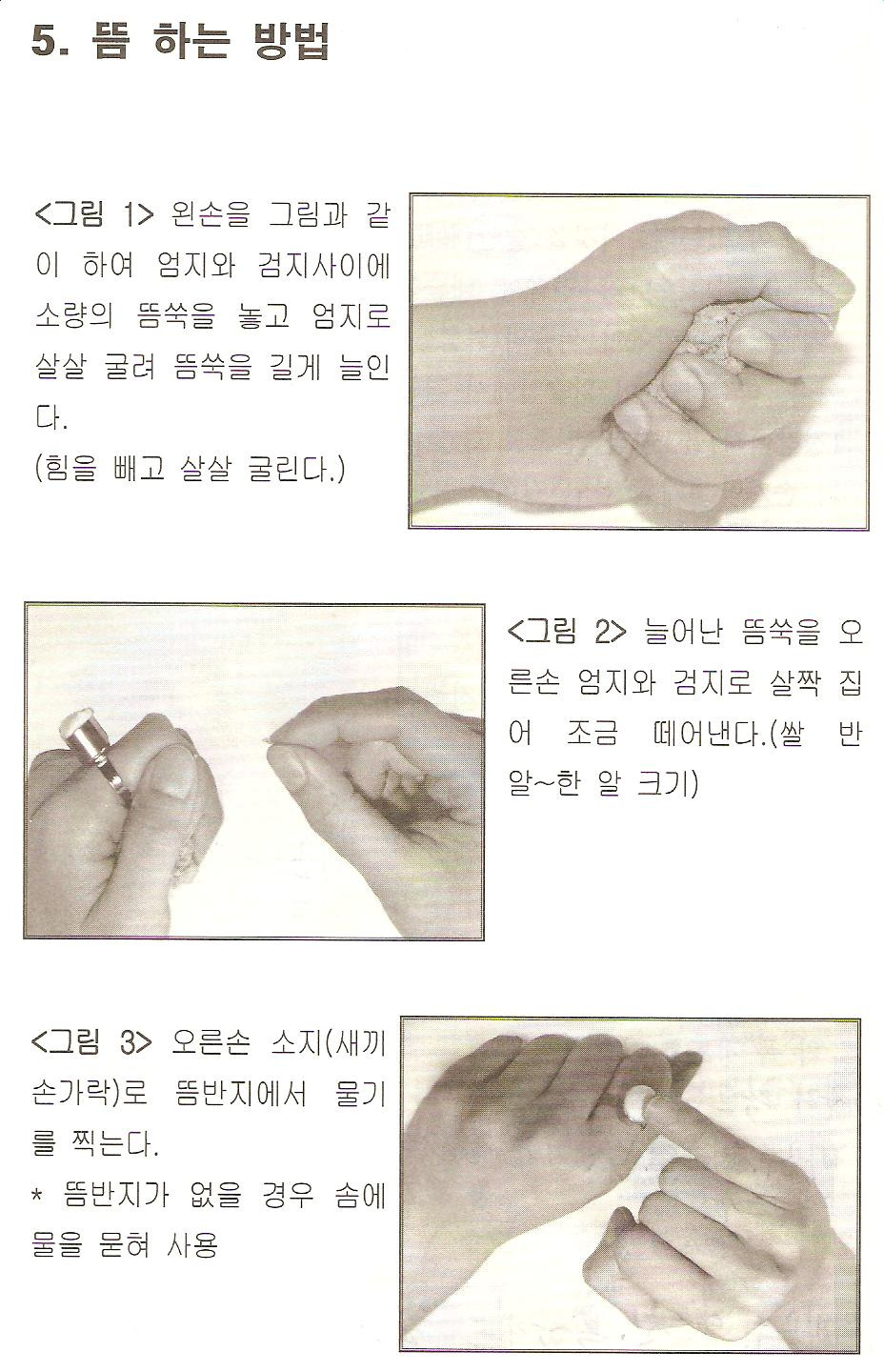 뜸 이미지
